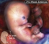 4D ultrasound and direct videography clips of prenatal development in the womb